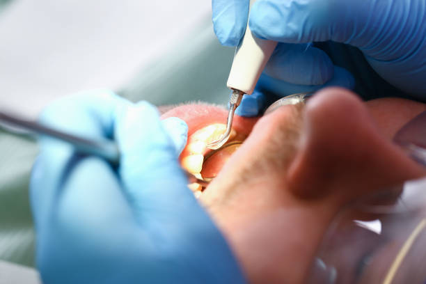 Best Broken Tooth Emergency  in Fern Prairie, WA