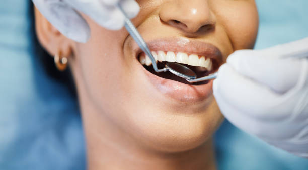 Best Urgent Tooth Repair  in Fern Prairie, WA